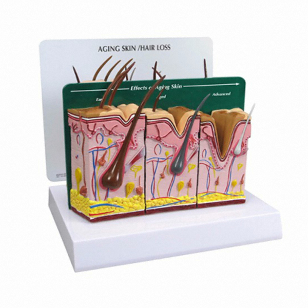 GPI G390 피부노화 및 탈모 3단계 모형