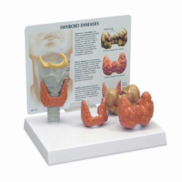 GPI G315 갑상선 질환 모형