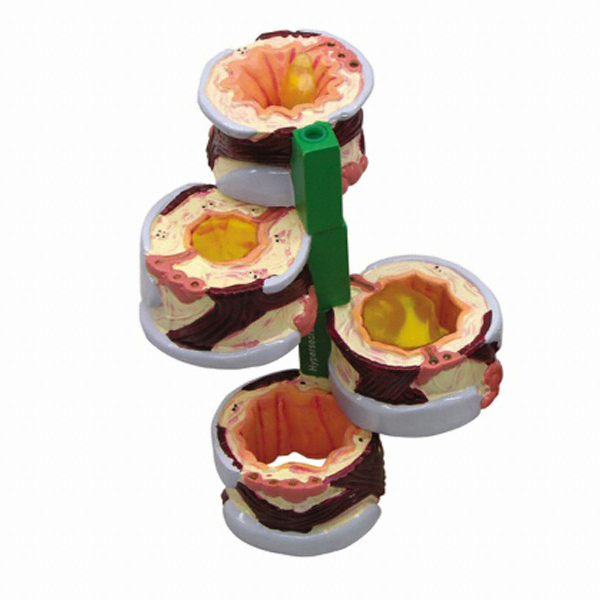 GPI G312 기관지모형 4분리